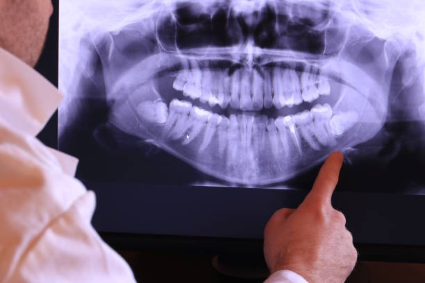 Best Emergency Broken Tooth Repair in Taft Heights, CA